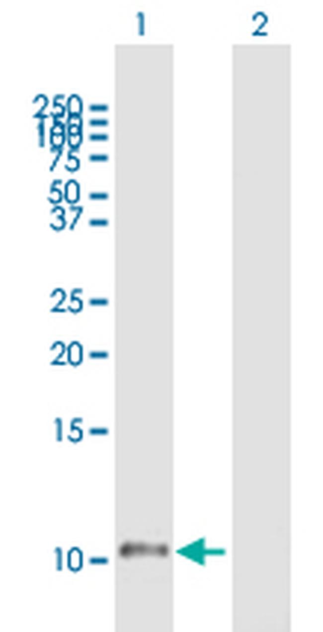 HTN1 Antibody in Western Blot (WB)