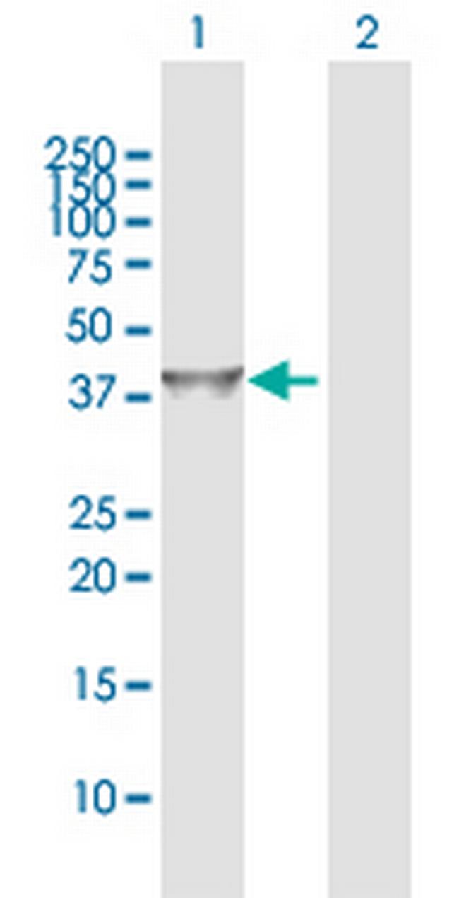 IDH3G Antibody in Western Blot (WB)