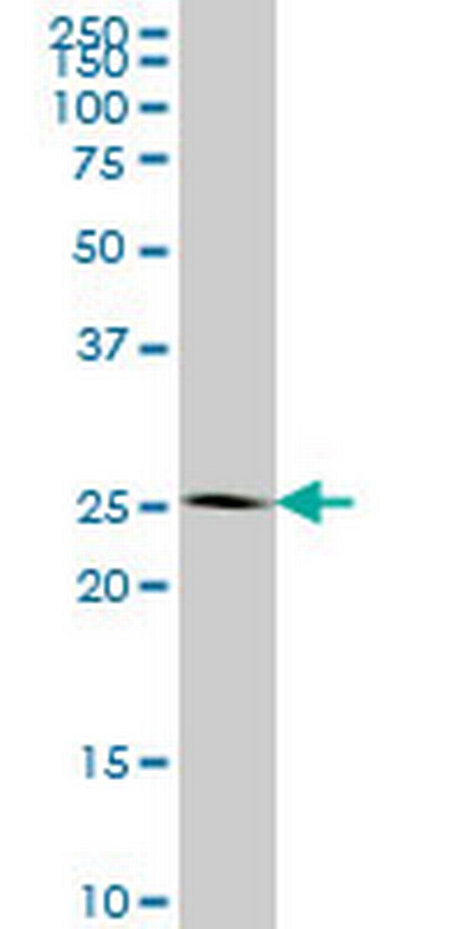 IDI1 Antibody in Western Blot (WB)