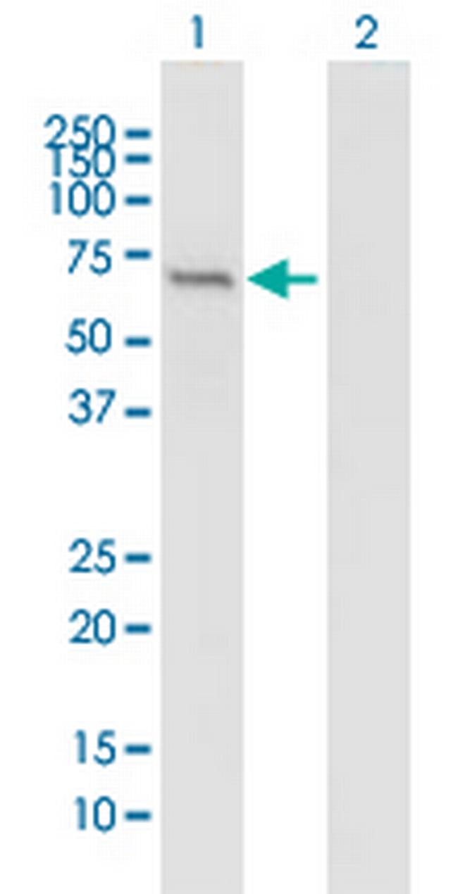 IFIT1 Antibody in Western Blot (WB)