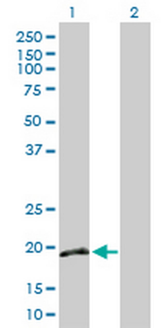 IFNA16 Antibody in Western Blot (WB)