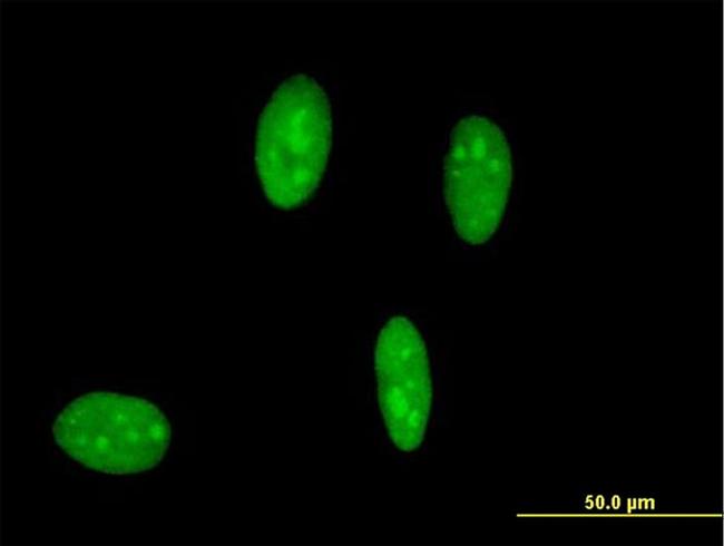 IFNR Antibody in Immunocytochemistry (ICC/IF)