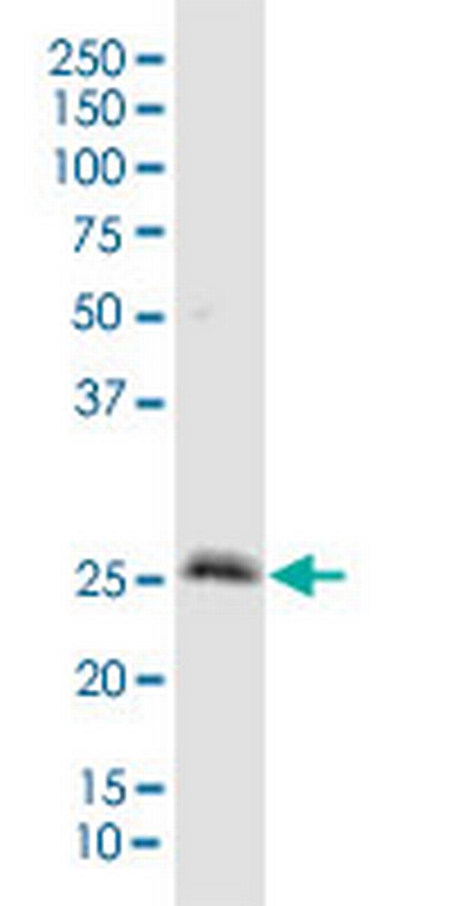 IGFBP3 Antibody in Western Blot (WB)