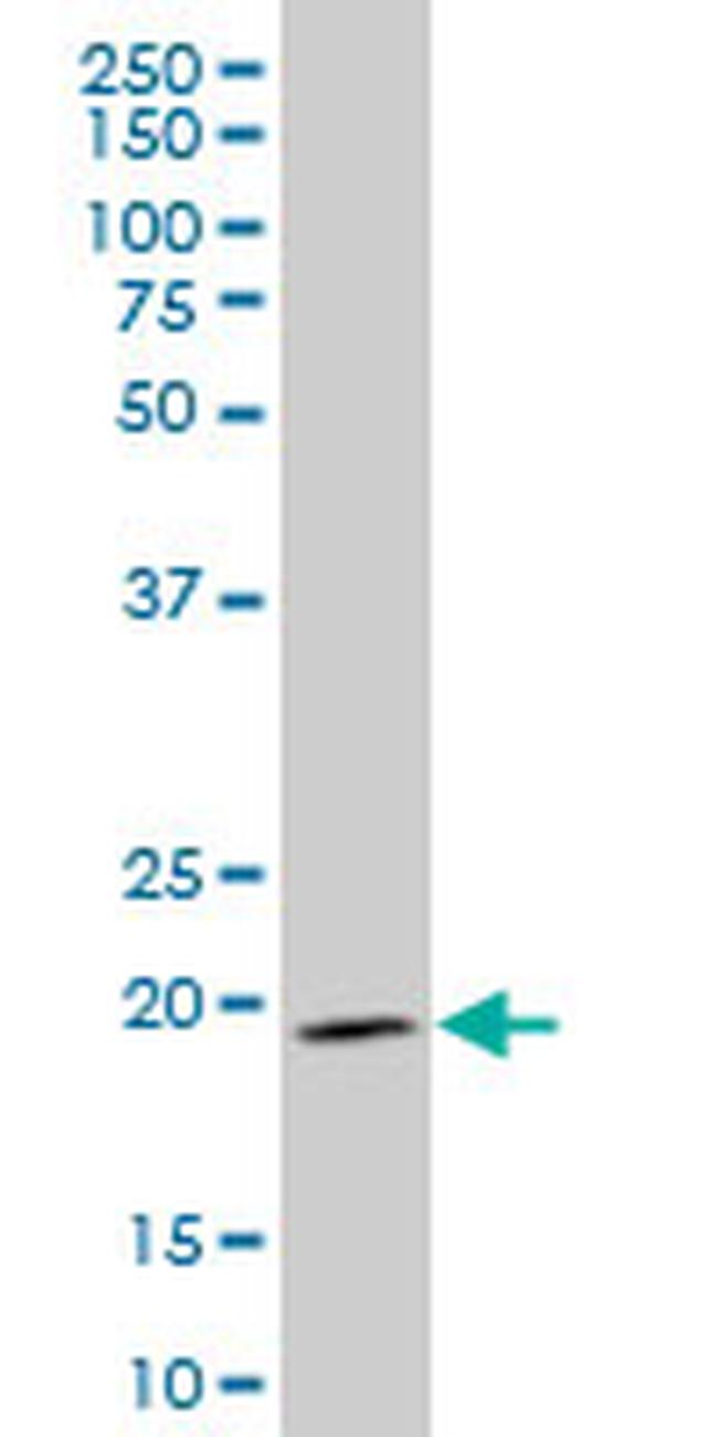 IHH Antibody in Western Blot (WB)