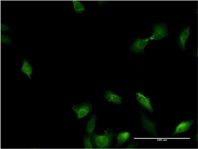 IL1A Antibody in Immunocytochemistry (ICC/IF)