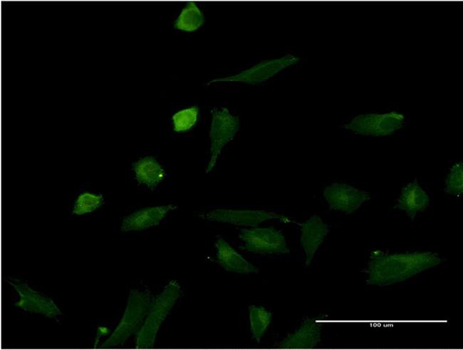 IL1A Antibody in Immunocytochemistry (ICC/IF)