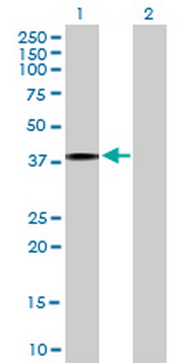 IL4R Antibody in Western Blot (WB)