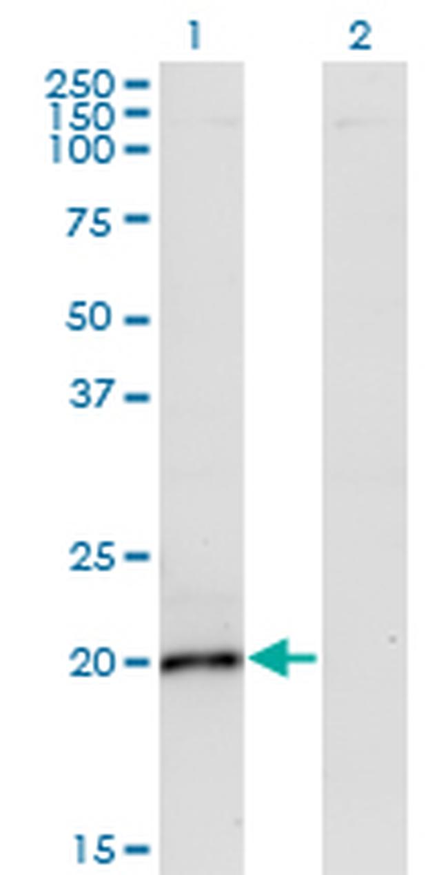 IL6 Antibody in Western Blot (WB)