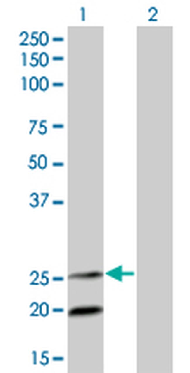 IL6 Antibody in Western Blot (WB)