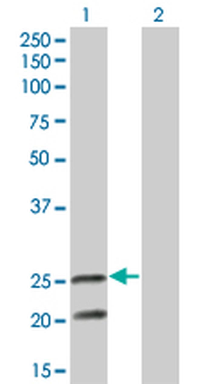 IL6 Antibody in Western Blot (WB)