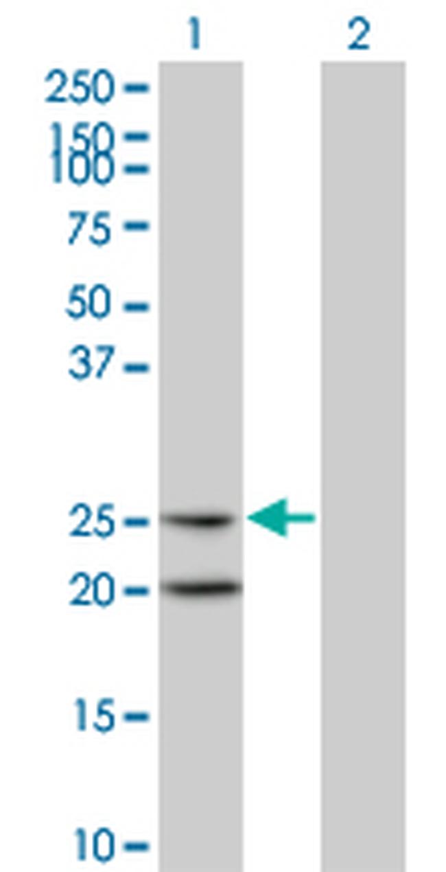 IL6 Antibody in Western Blot (WB)