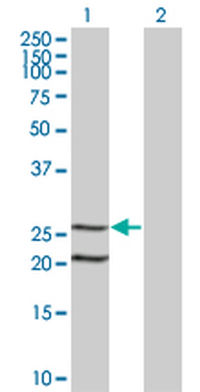 IL6 Antibody in Western Blot (WB)