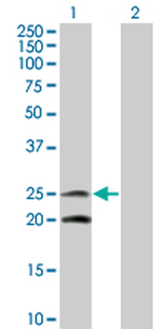 IL6 Antibody in Western Blot (WB)