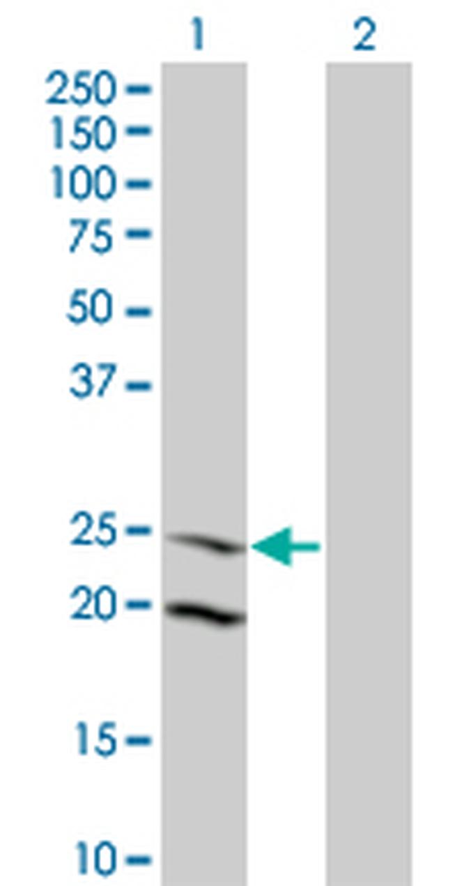 IL6 Antibody in Western Blot (WB)