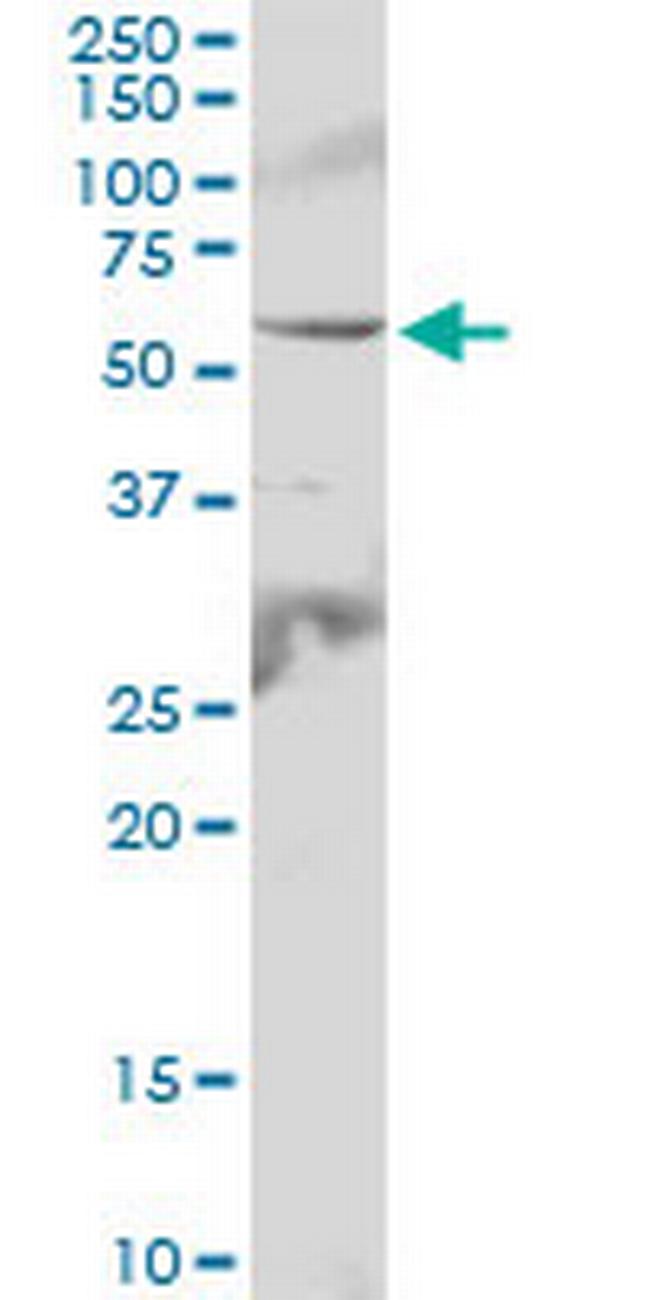 IL6R Antibody in Western Blot (WB)