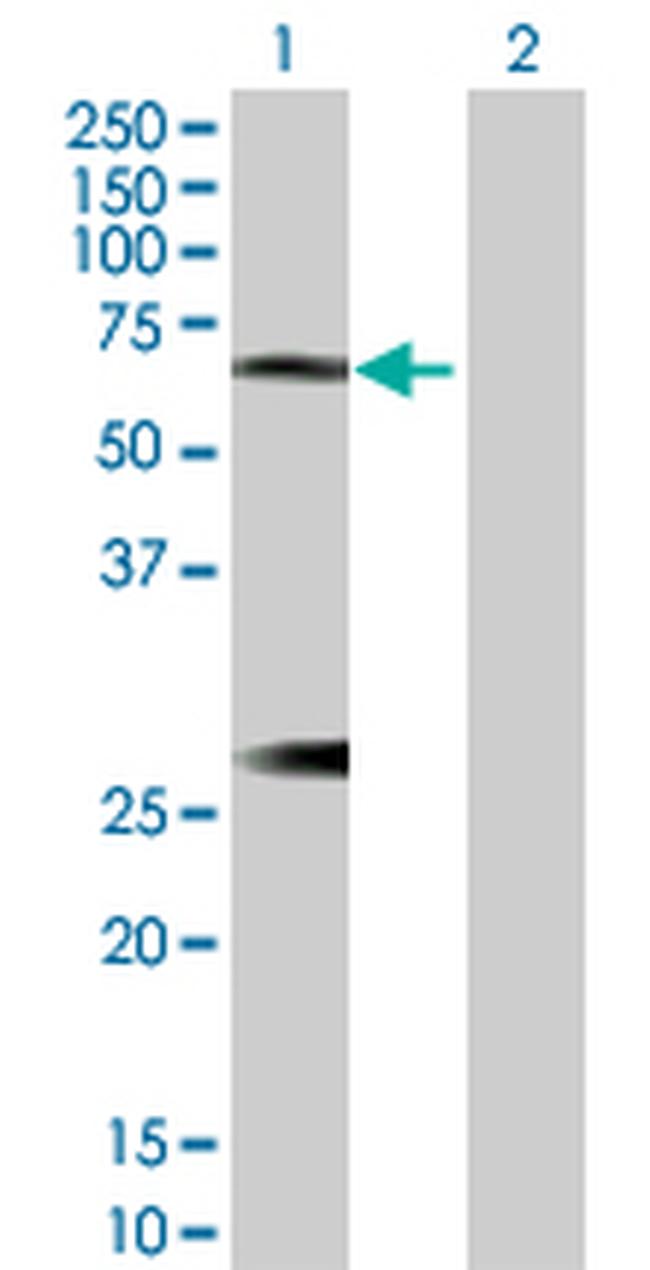 IL6R Antibody in Western Blot (WB)