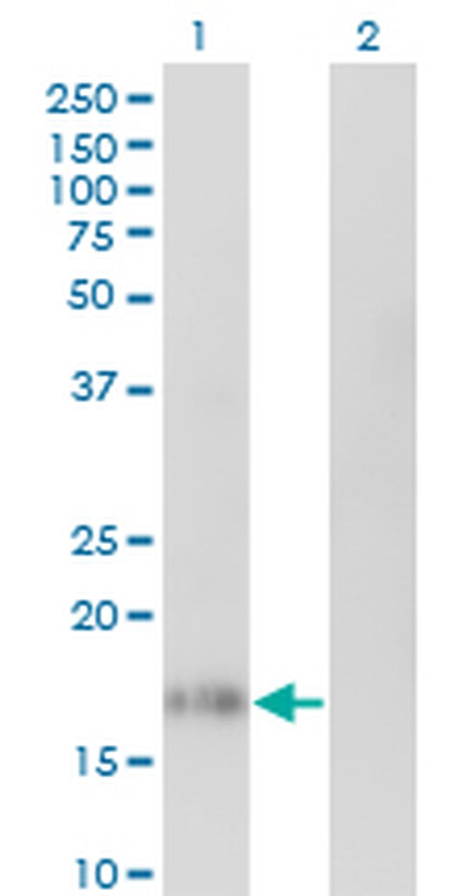 IL10 Antibody in Western Blot (WB)