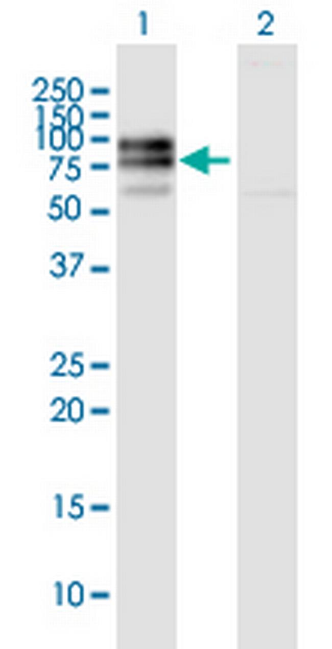 IL10RA Antibody in Western Blot (WB)