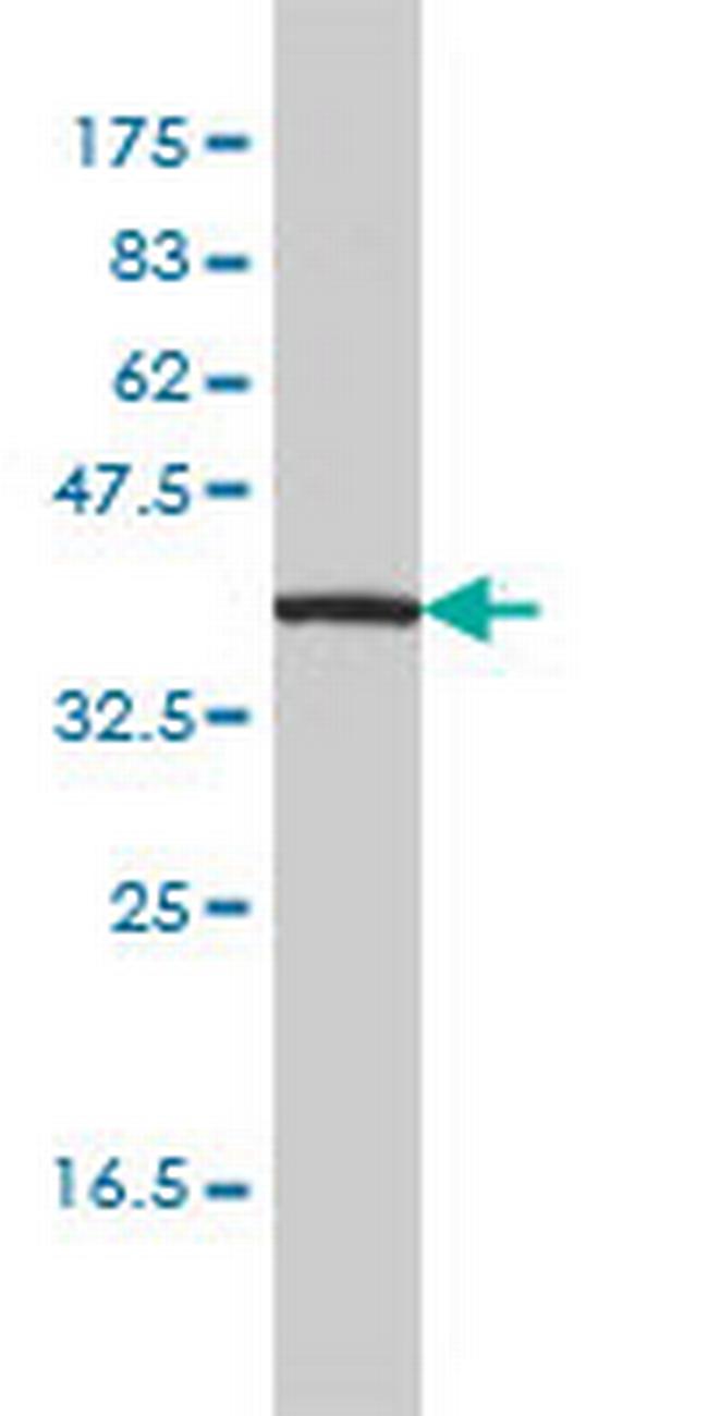 IL11RA Antibody in Western Blot (WB)