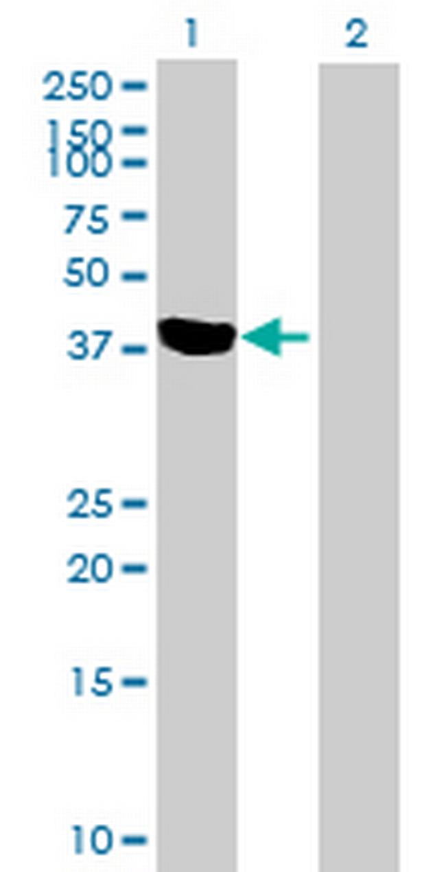 IL12RB1 Antibody in Western Blot (WB)