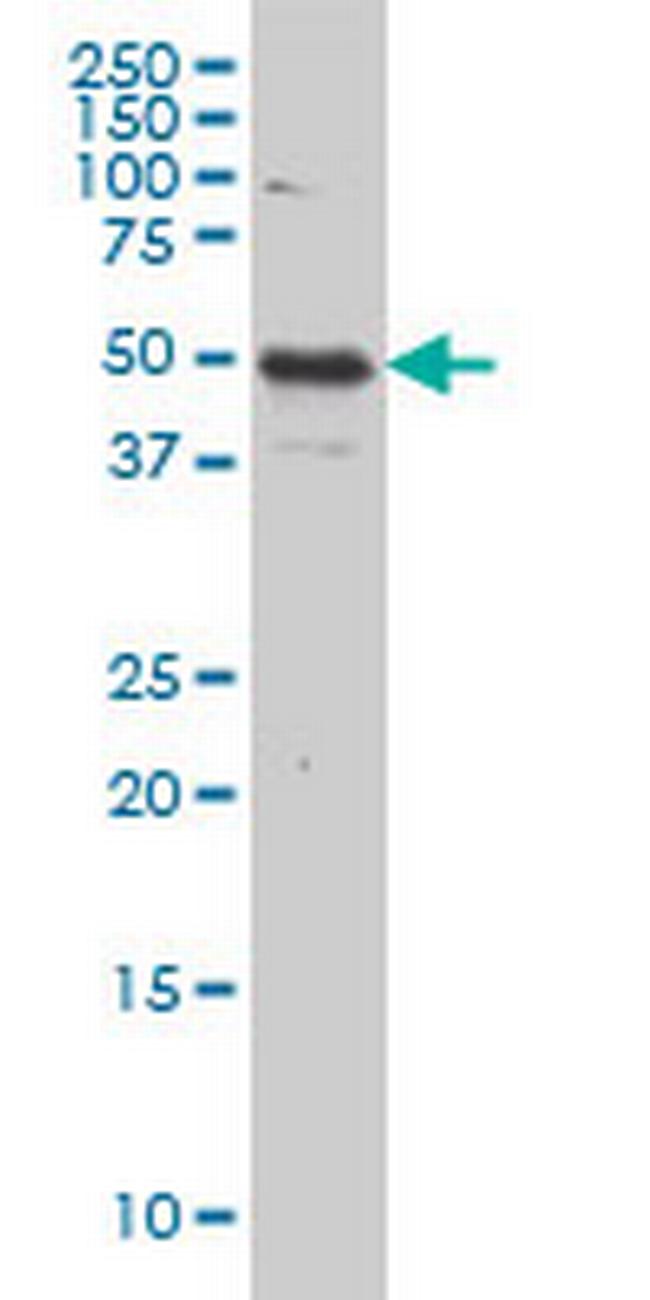 IL13RA2 Antibody in Western Blot (WB)