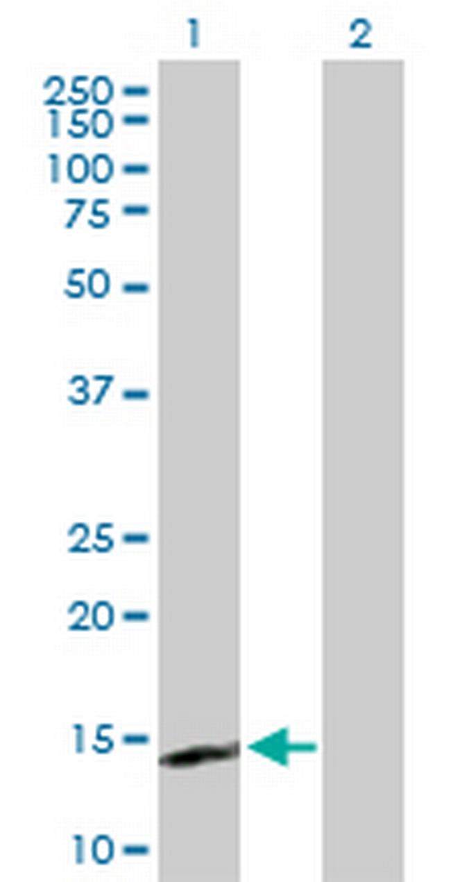 IL15 Antibody in Western Blot (WB)