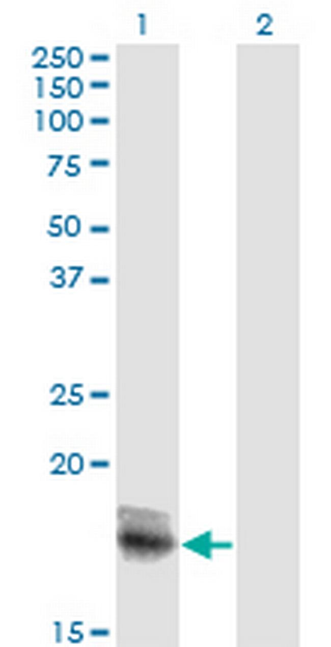 IL15 Antibody in Western Blot (WB)