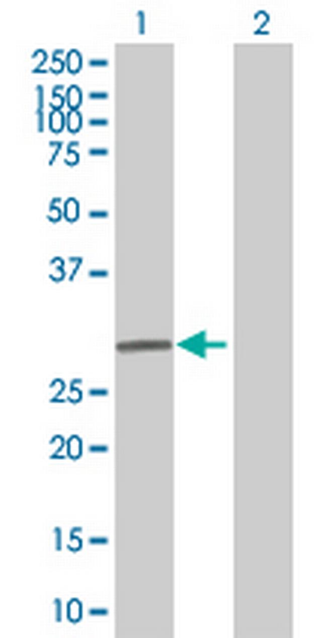 IMPA1 Antibody in Western Blot (WB)