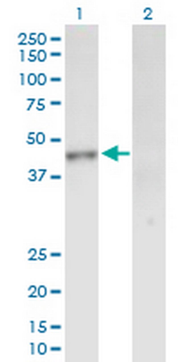 INPP1 Antibody in Western Blot (WB)