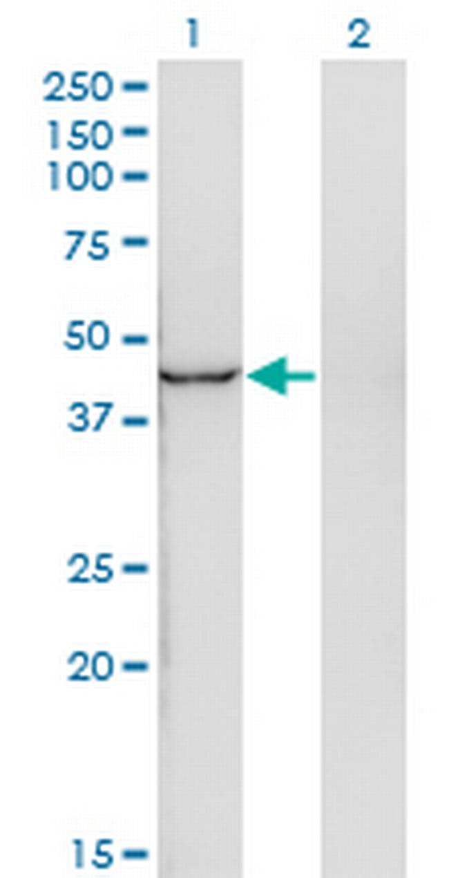 INPP1 Antibody in Western Blot (WB)