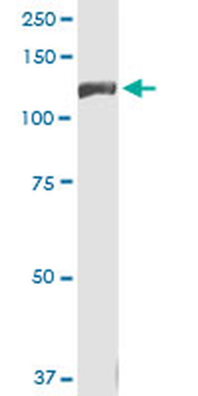 INSRR Antibody in Western Blot (WB)