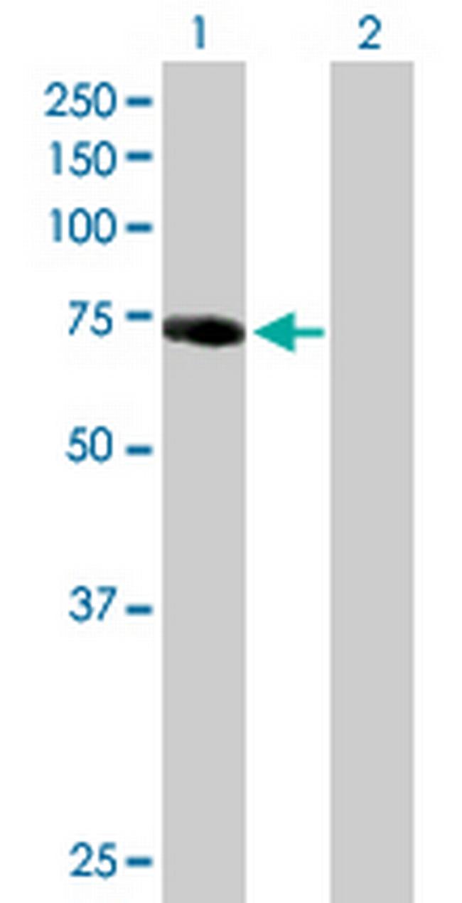 IRAK1 Antibody in Western Blot (WB)