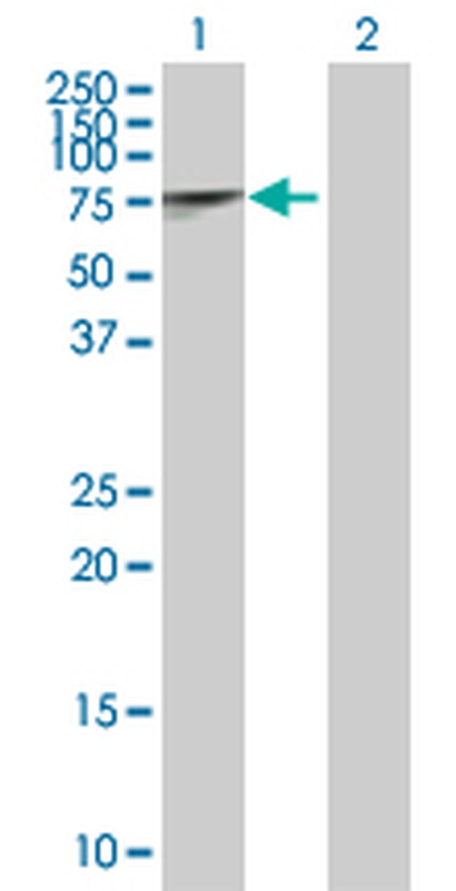 IRAK1 Antibody in Western Blot (WB)