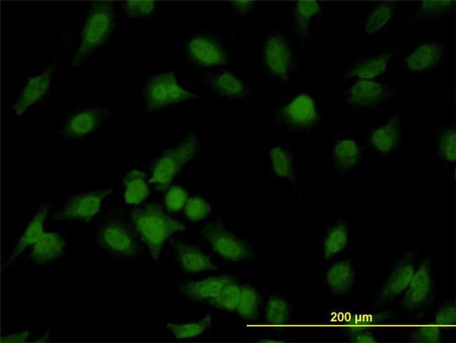 IRAK1 Antibody in Immunocytochemistry (ICC/IF)