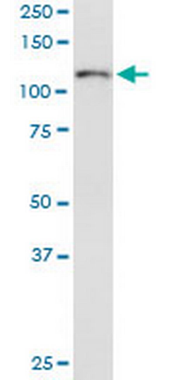 ITGA6 Antibody in Western Blot (WB)