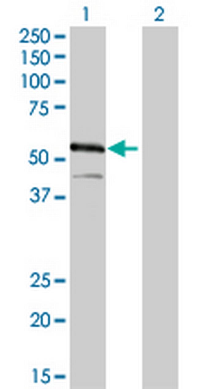 IRF4 Antibody in Western Blot (WB)