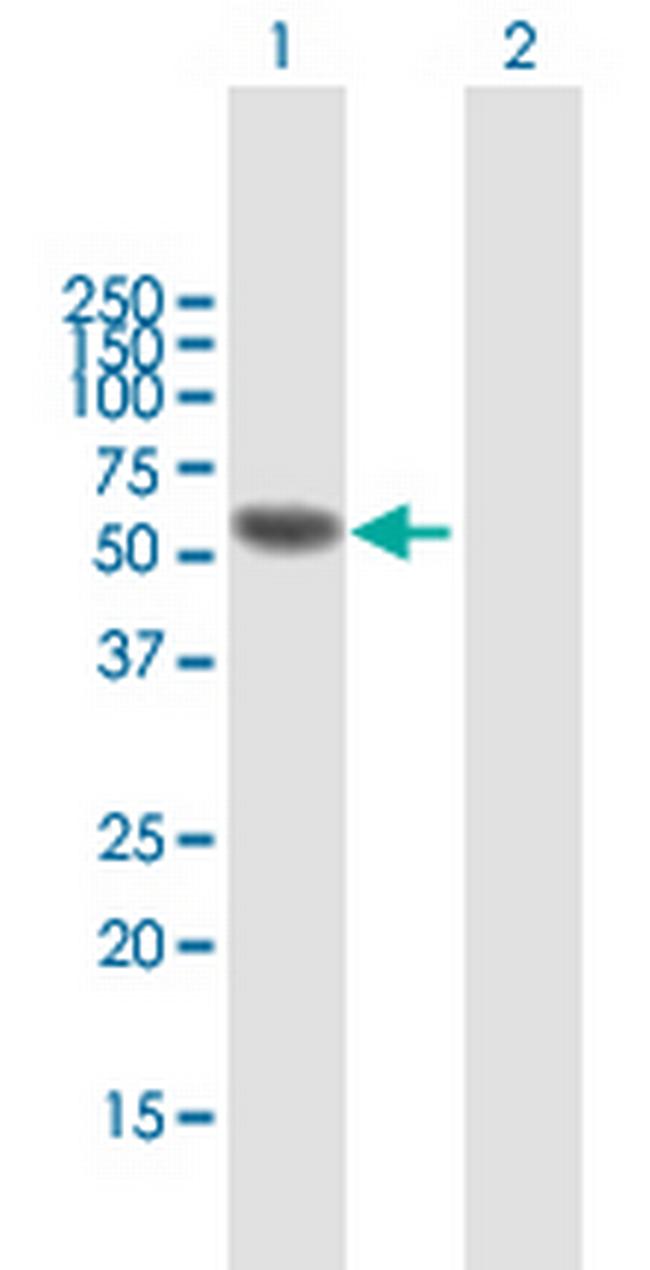 IRF6 Antibody in Western Blot (WB)