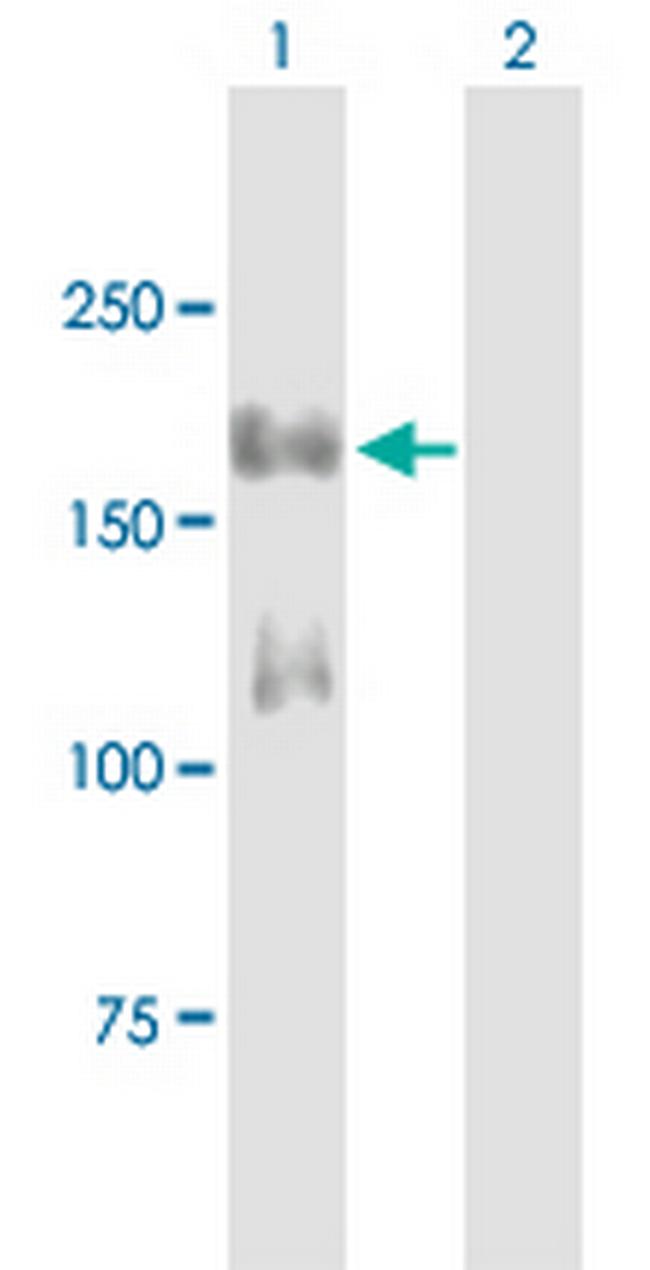 IRS1 Antibody in Western Blot (WB)