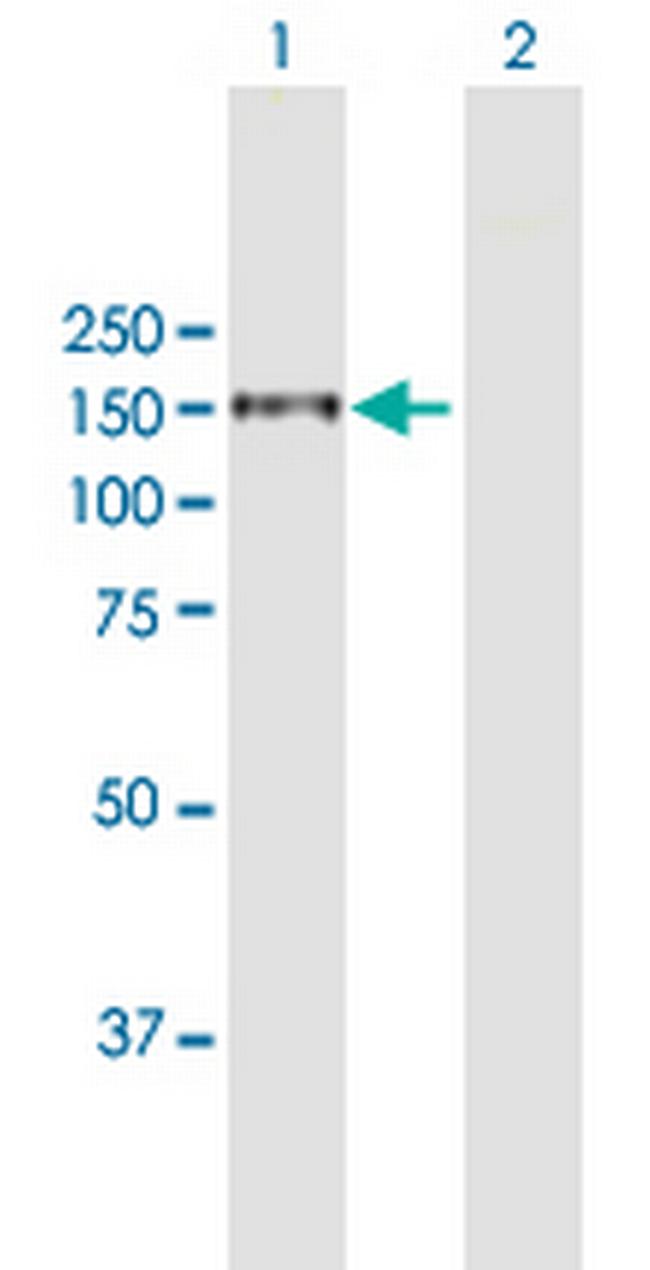 ITGA4 Antibody in Western Blot (WB)