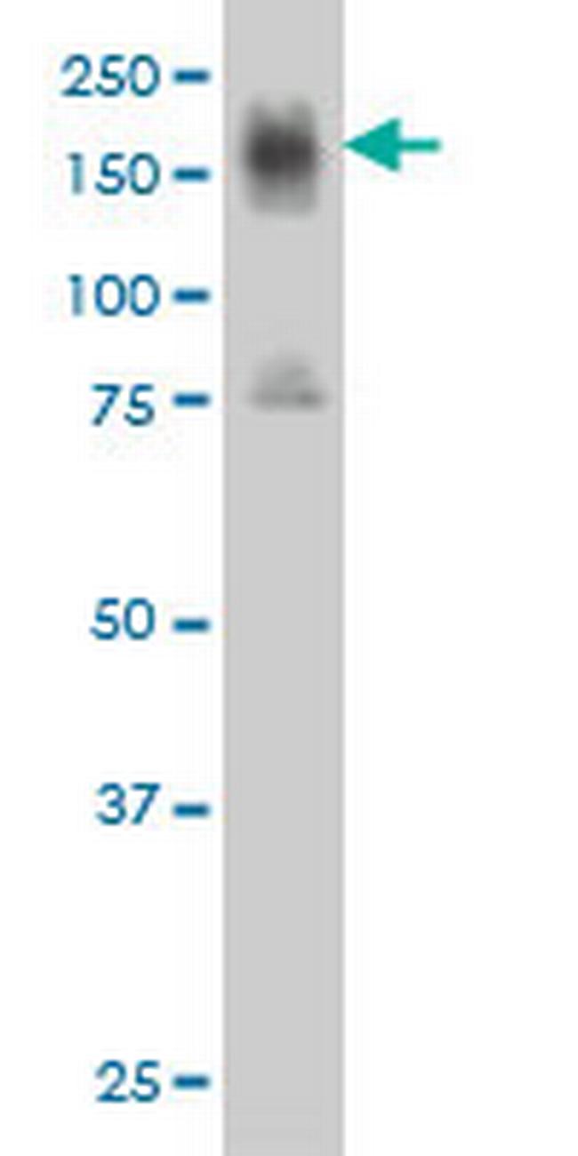 ITGA4 Antibody in Western Blot (WB)