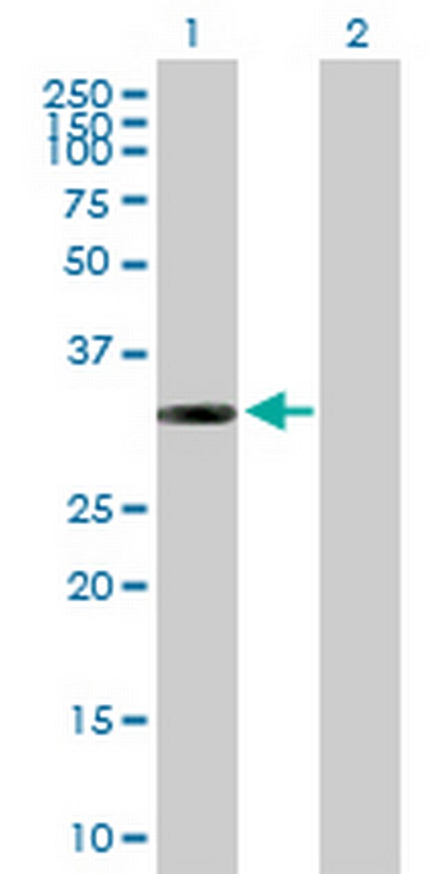 ITPK1 Antibody in Western Blot (WB)