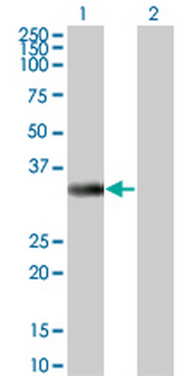 ITPK1 Antibody in Western Blot (WB)