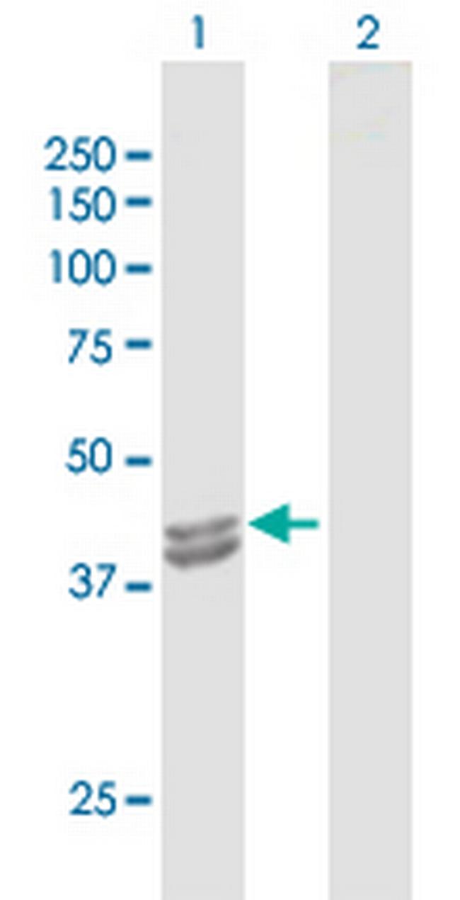 IVD Antibody in Western Blot (WB)