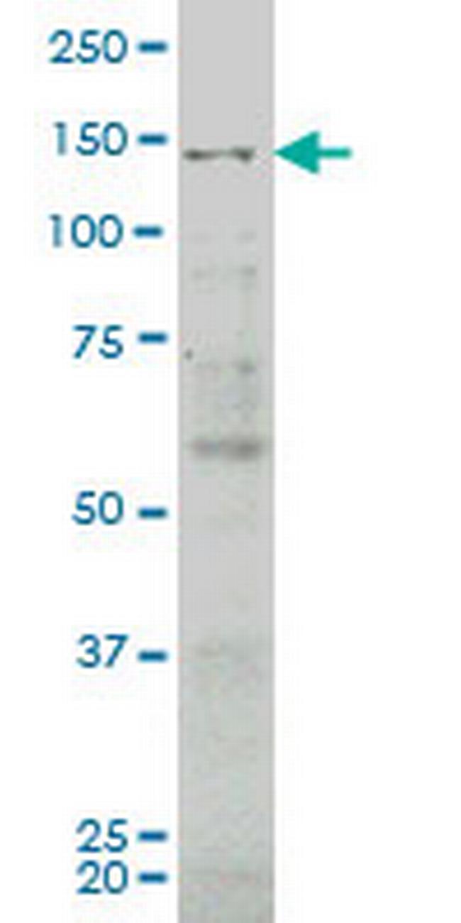 JAG2 Antibody in Western Blot (WB)