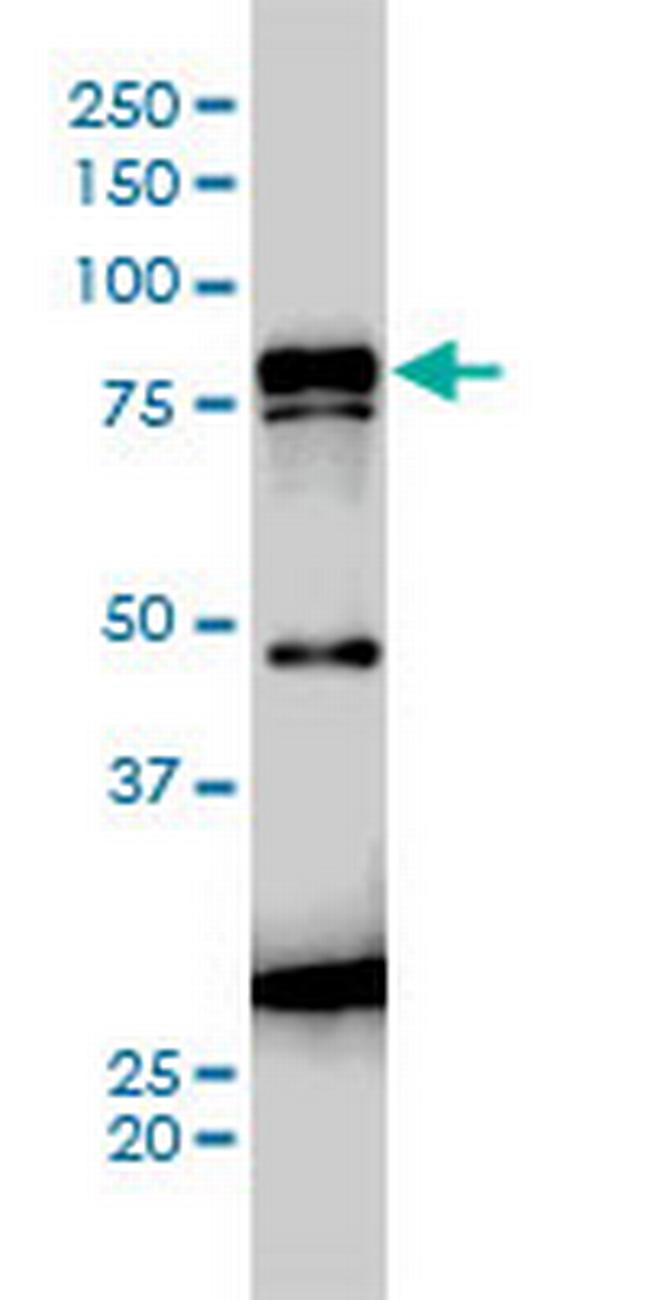 JUP Antibody in Western Blot (WB)