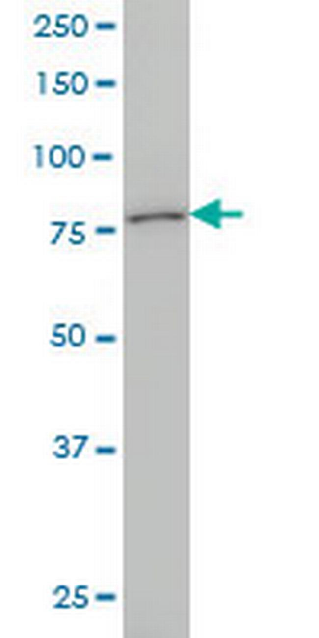 KCNC3 Antibody in Western Blot (WB)