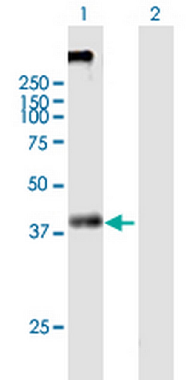 KCNN4 Antibody in Western Blot (WB)