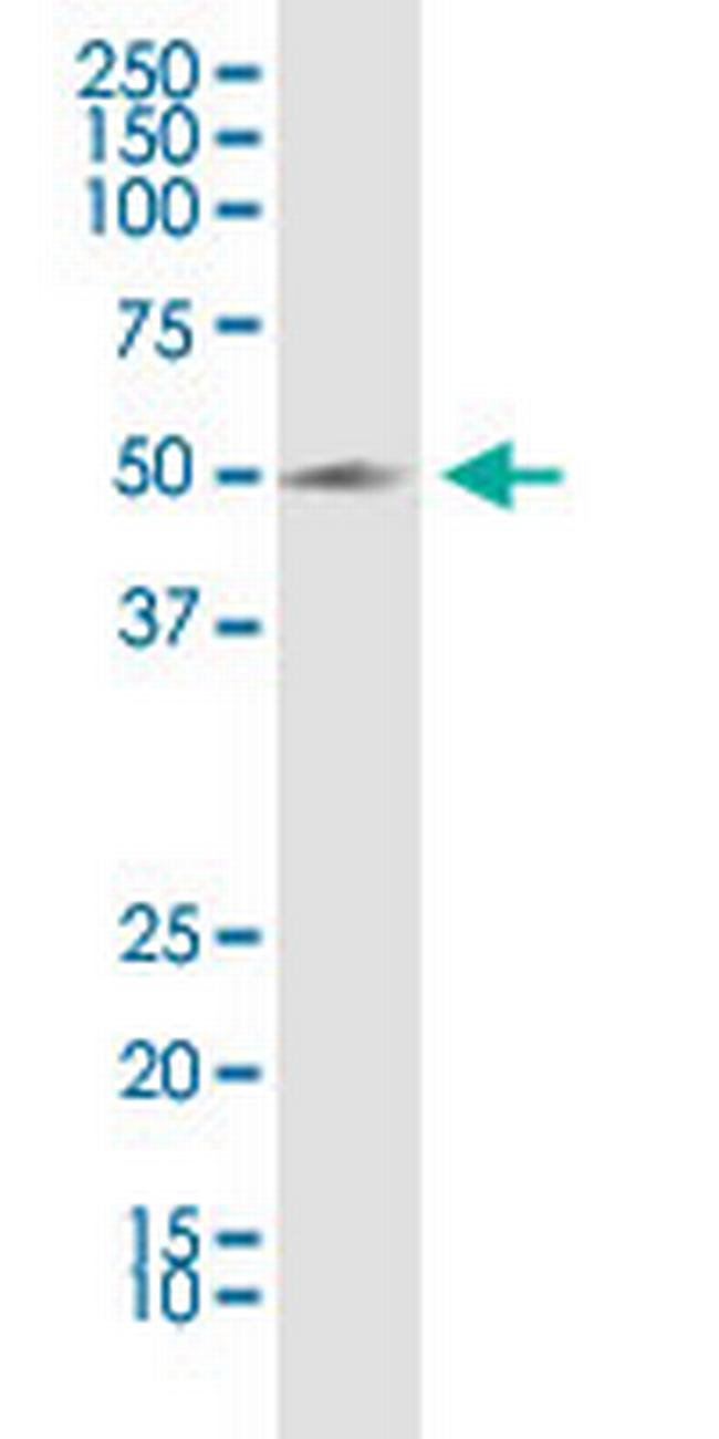 KCNN4 Antibody in Western Blot (WB)