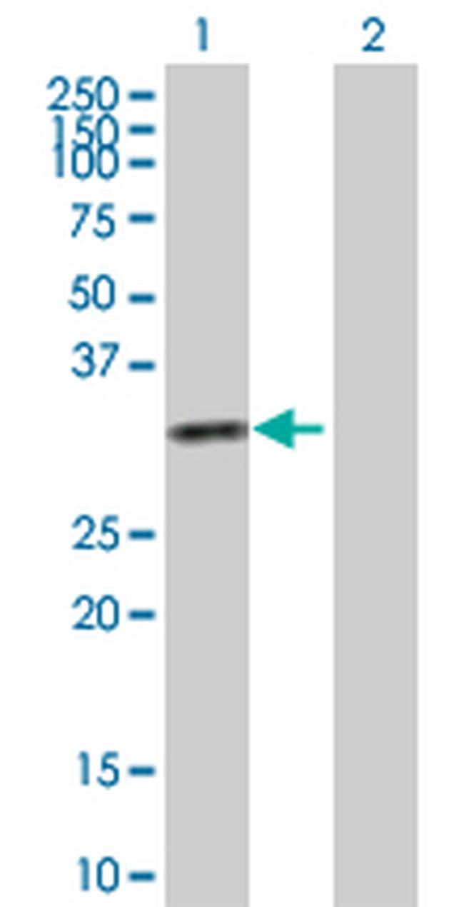 KHK Antibody in Western Blot (WB)