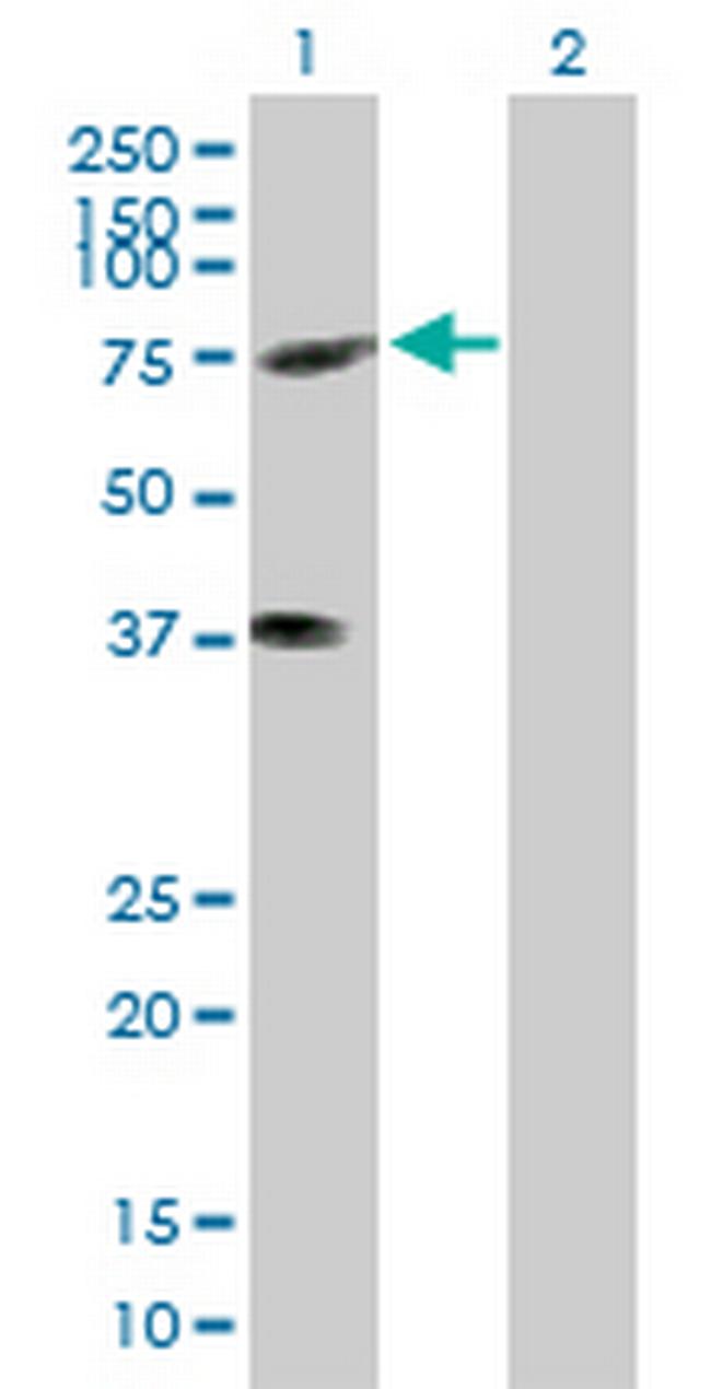 KIFC3 Antibody in Western Blot (WB)